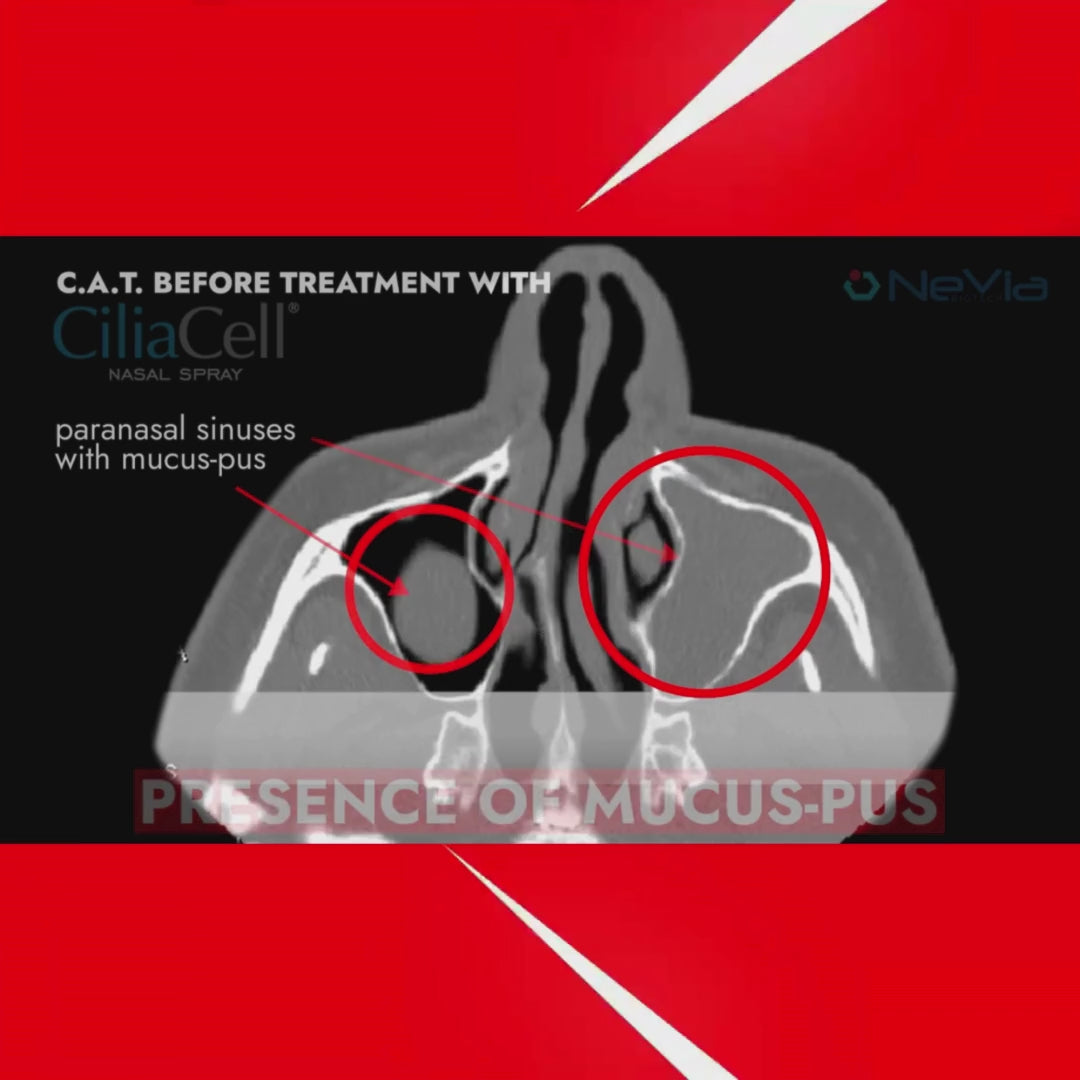Carica video: CiliaCell Spray Nasale - Adulti